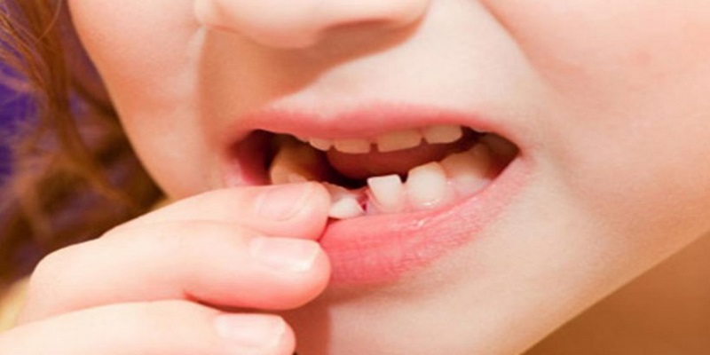 Mơ thấy răng bị gãy hoặc rụng thường thể hiện sự cảm thấy bất lực